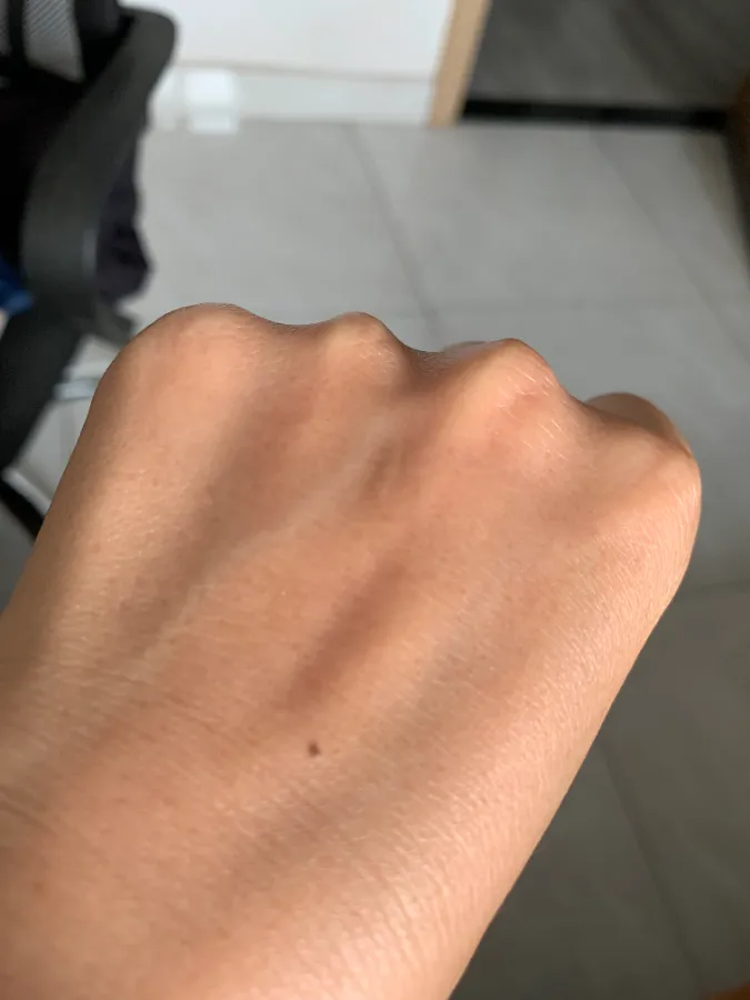 Da tay sau, nám mờ dần