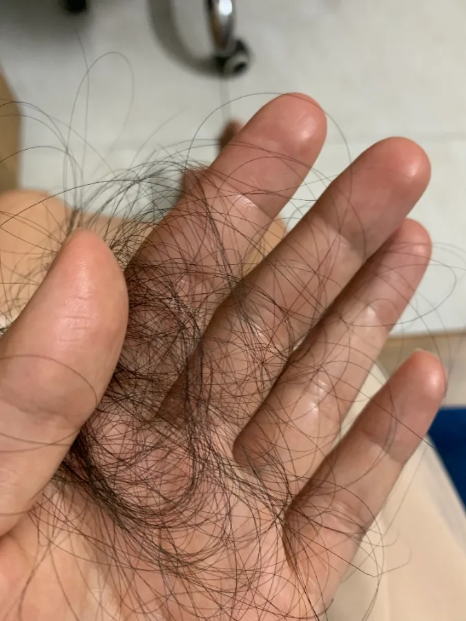 Tóc trước khi áp dụng phương pháp